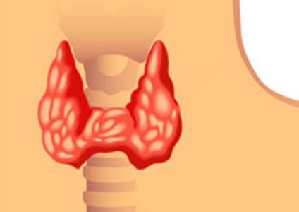 Krankenhaus lange wie nach im op schilddrüsen Erkrankung an